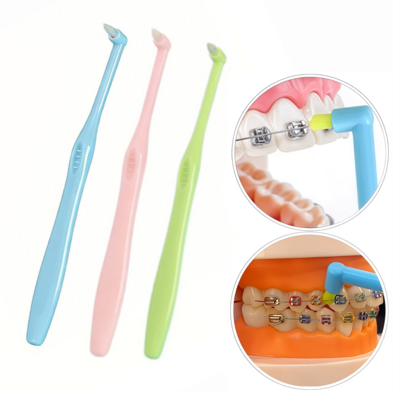 Teeth Whitening With Braces - 1/3 Stück Zahnspangen-Zahnbürste mit einzelnen Borsten