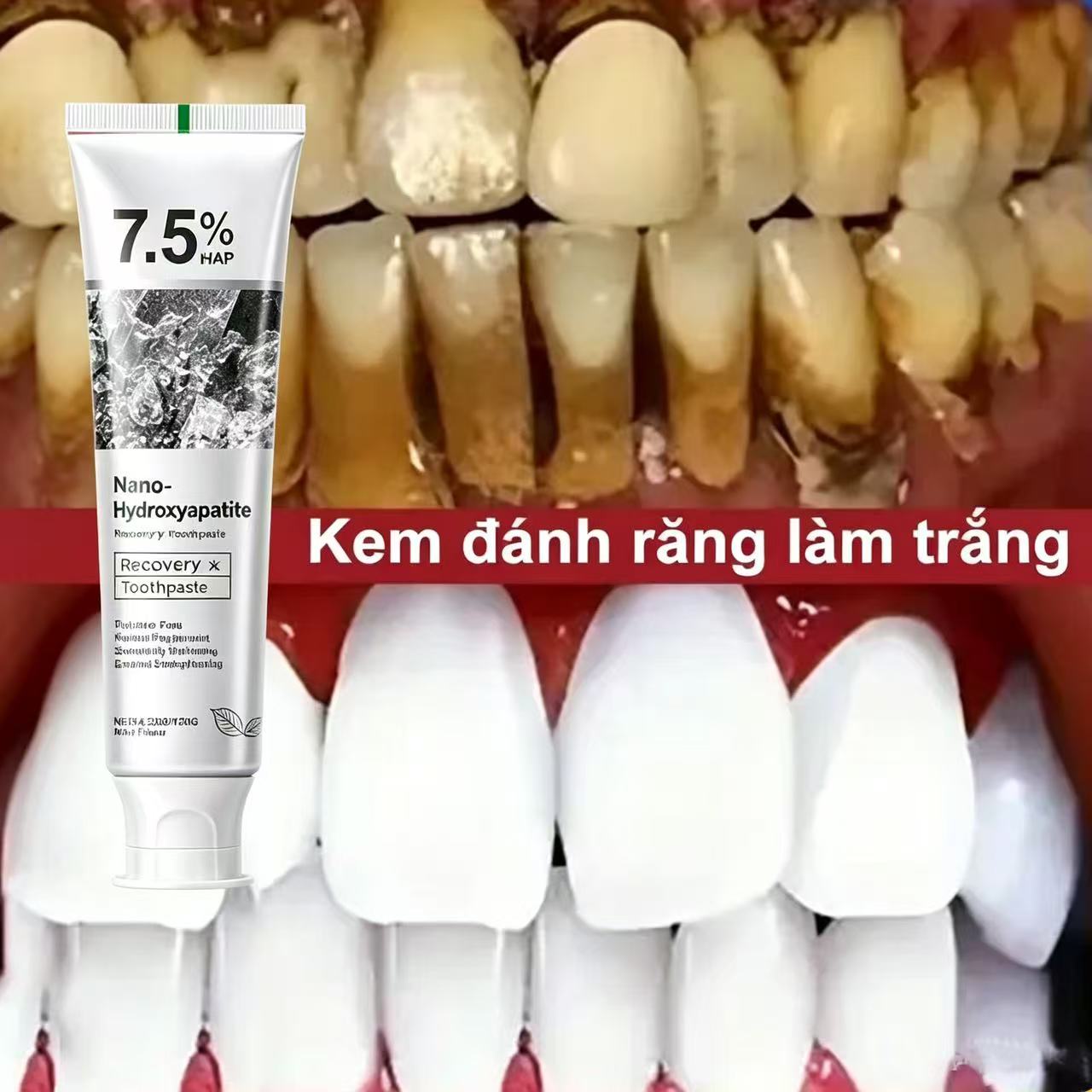 Teeth Whitening Toothpaste - 7,5% Hydroxyapatit Probiotische Zahnaufhellungs-Zahnpasta Zahnschmelz- und