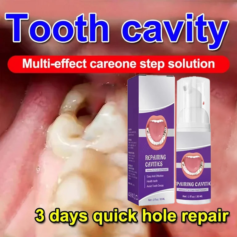 Teeth Whitening Toothpaste - Zahnreinigung Zahnpasta Entfernt Zahnflecken Zahnaufhellung Zahnkariesreparatur