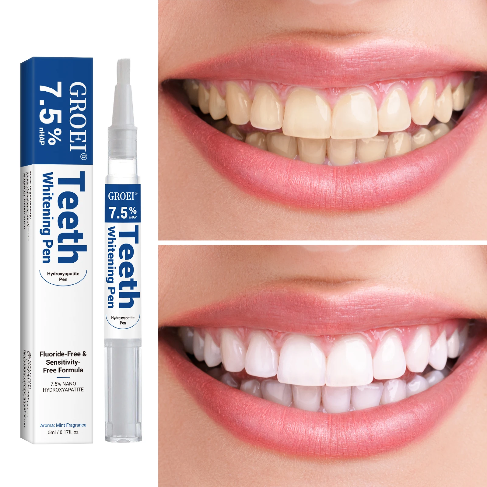 Hydroxyapatite Zahnaufhellungs – Teeth Whitening Price Bewertung und Preis