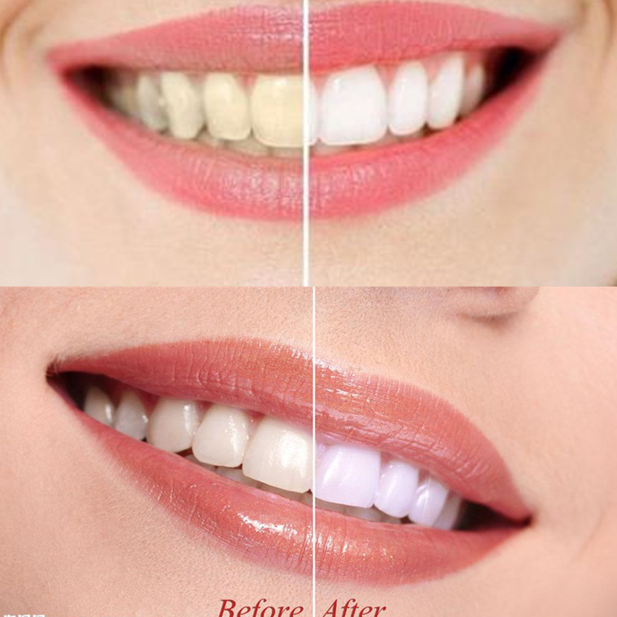Bambus Holzkohle Zähne Zahn De – Teeth Whitening Charcoal Bewertung und Preis