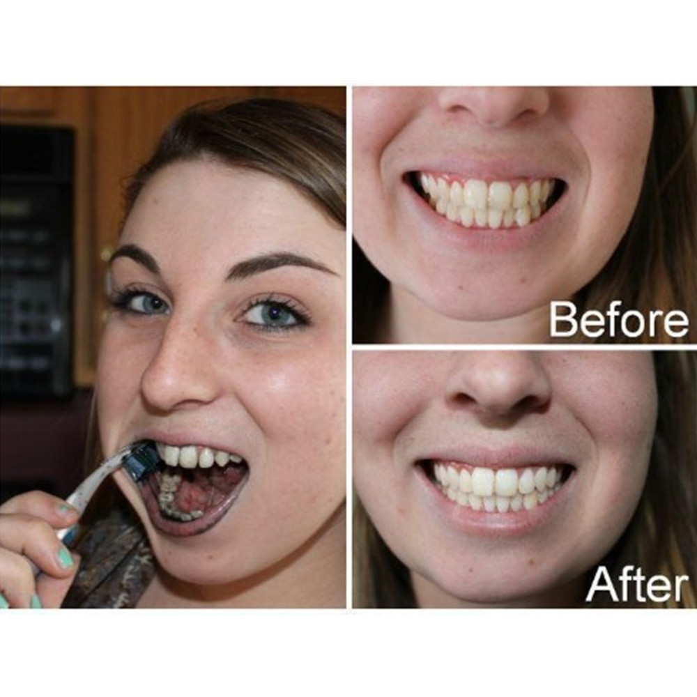 Bambus Holzkohle Zähne Zahn De – Teeth Whitening Charcoal Bewertung und Preis