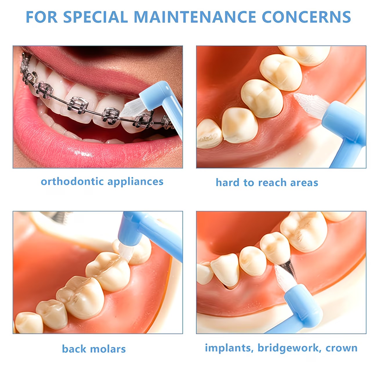 1/3 Stück Zahnspangen-Zahnbürs – Teeth Whitening With Braces Bewertung und Preis