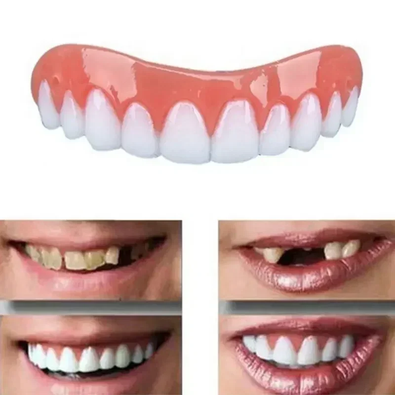 Neue Silikon-Zahnprothesen für – Teeth Whitening With Braces Bewertung und Preis