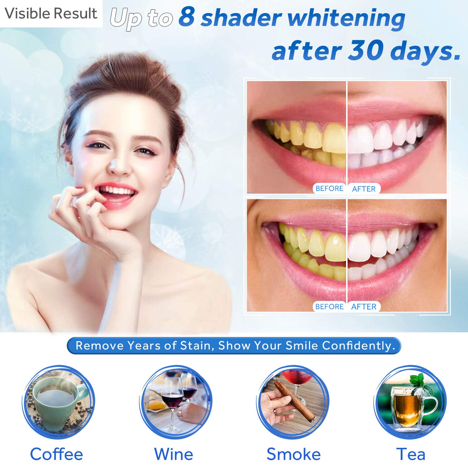 Zahnaufhellungsgel, Nachfüllsp – Teeth Whitening Price Bewertung und Preis