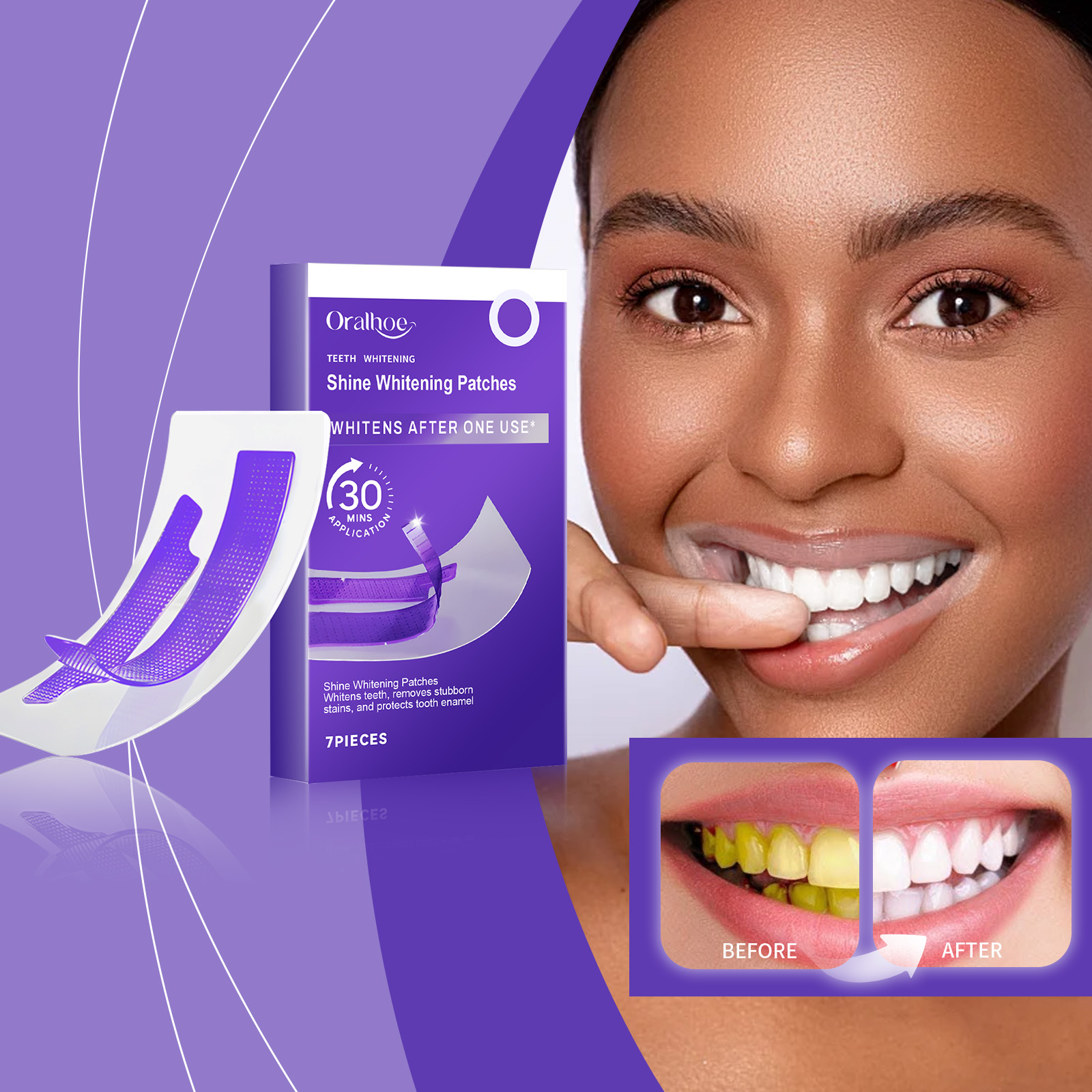 Lila Zahnaufhellungsstreifen – – Teeth Whitening Retainer Bewertung und Preis