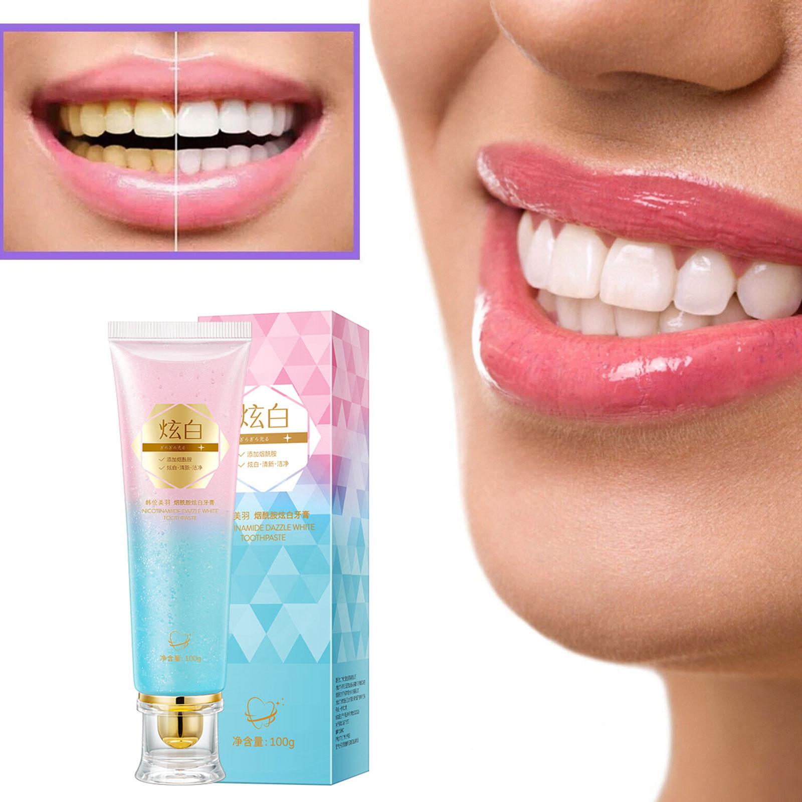 Niacinamid Whitening Zahnpasta – Teeth Whitening Toothpaste Bewertung und Preis