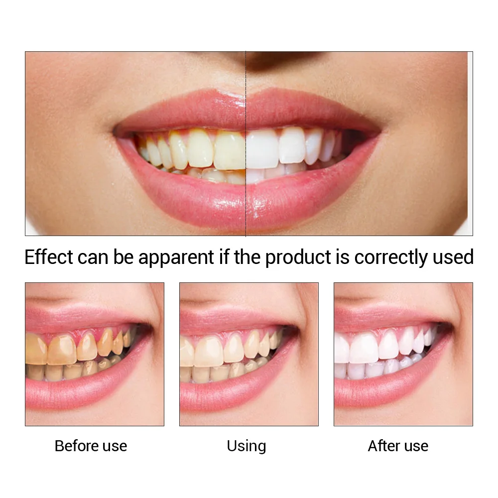 FTEENPLY Zahnaufhellung Essenz – Teeth Whitening Ingredients Bewertung und Preis