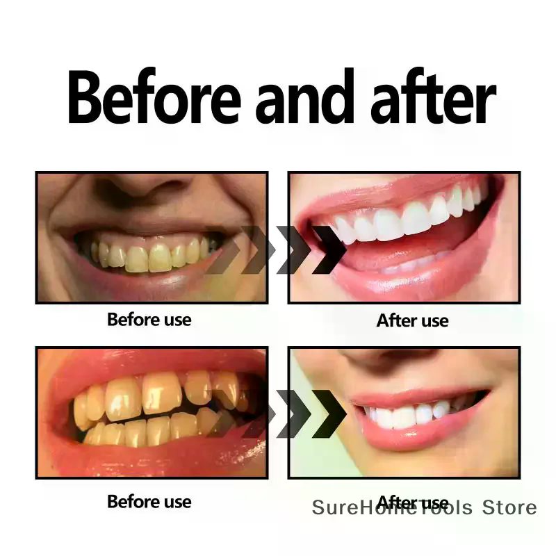 Bambuskohlepulver für die Zähn – Teeth Whitening Charcoal Bewertung und Preis