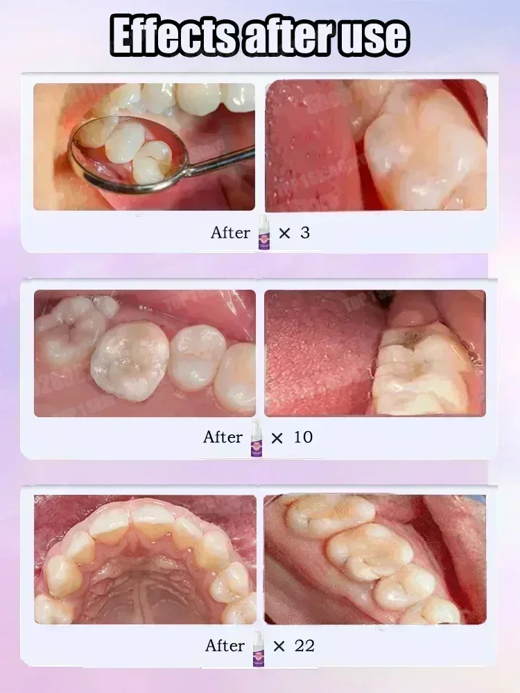 Heiße Verkäufe Bestseller, wis – Teeth Whitening Toothpaste Bewertung und Preis