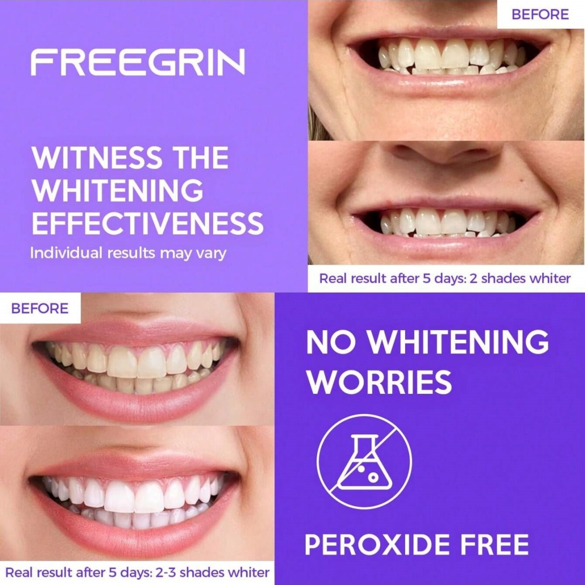 Deluxe Zahnaufhellungsaufklebe – Teeth Whitening Hydrogen Peroxide Bewertung und Preis