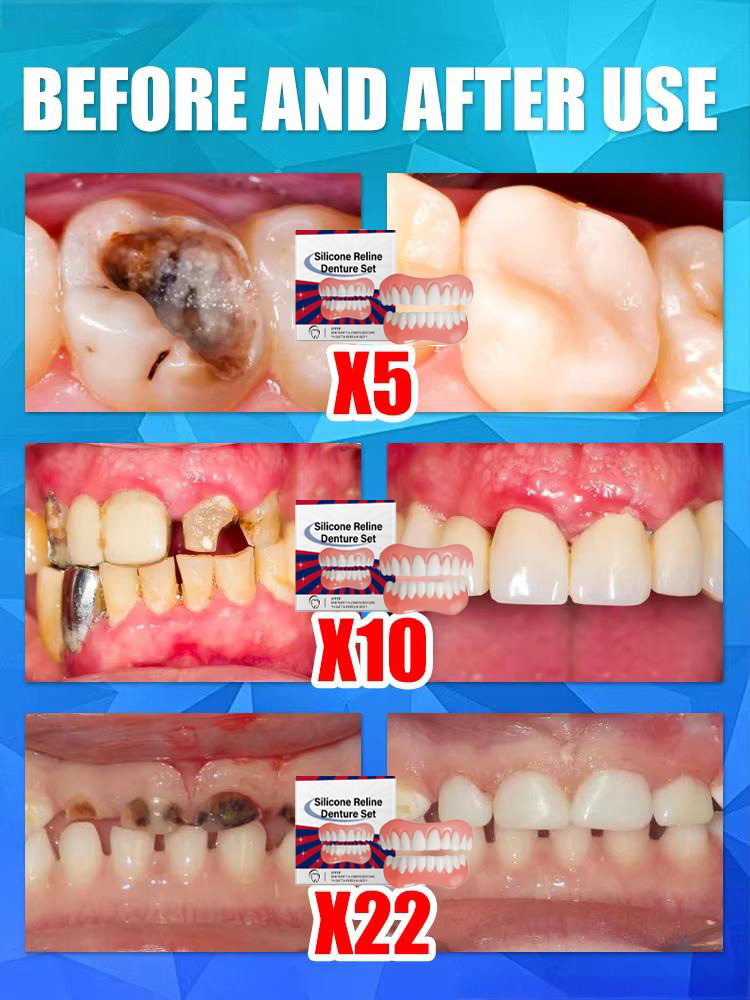 Falsche Zähne, Silikon-Obermat – Teeth Whitening With Braces Bewertung und Preis