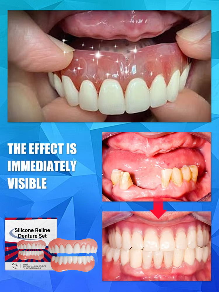 Falsche Zähne, Silikon-Obermat – Teeth Whitening With Braces Bewertung und Preis