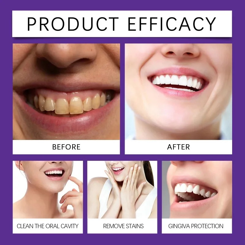 Lila Zahnrestaurations-Mineral – Teeth Whitening Ingredients Bewertung und Preis
