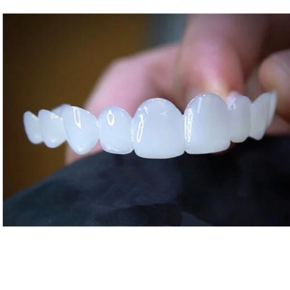 Zahnaufhellungs-Veneers Tempor – Teeth Whitening With Braces Bewertung und Preis