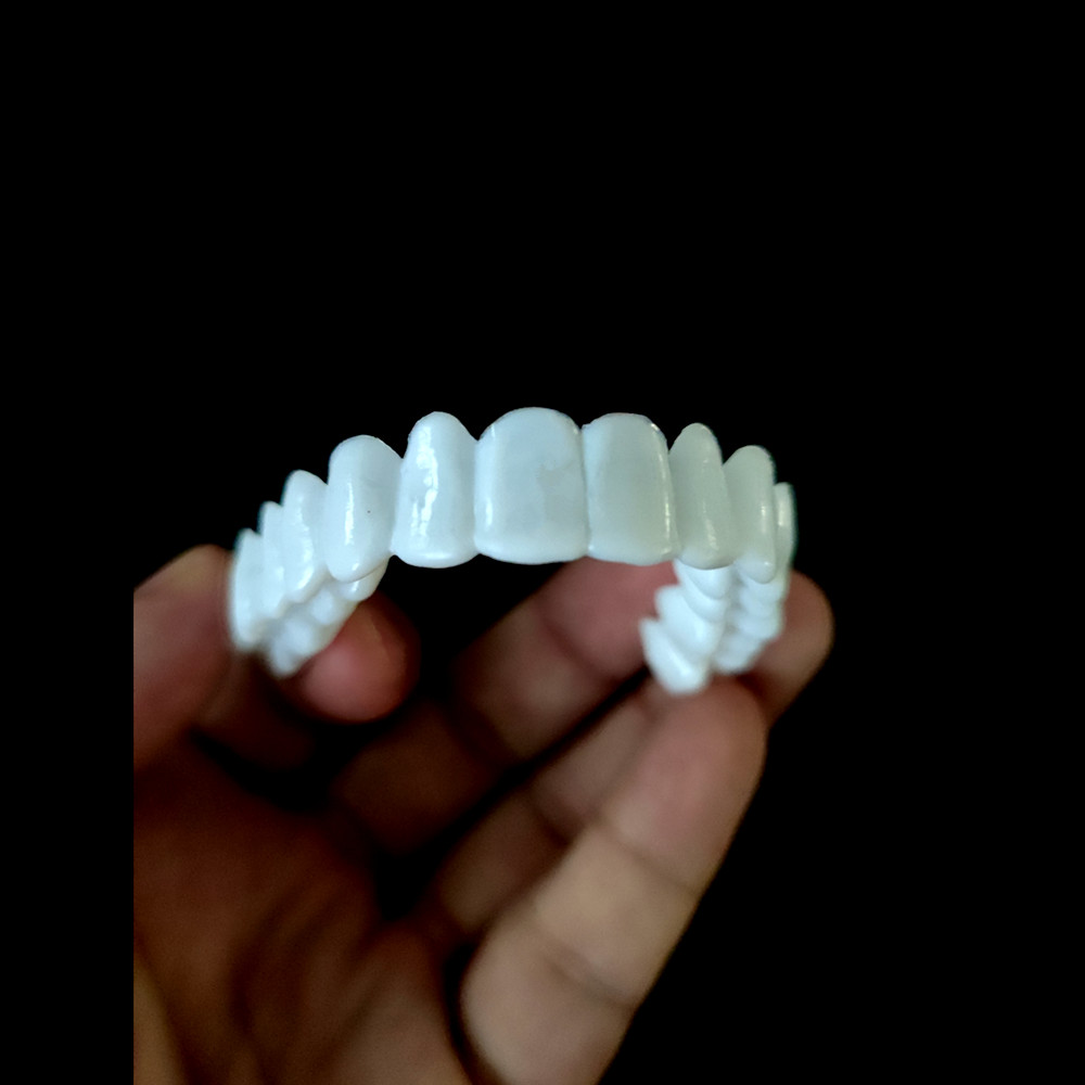 Zahnaufhellungs-Veneers Tempor – Teeth Whitening With Braces Bewertung und Preis