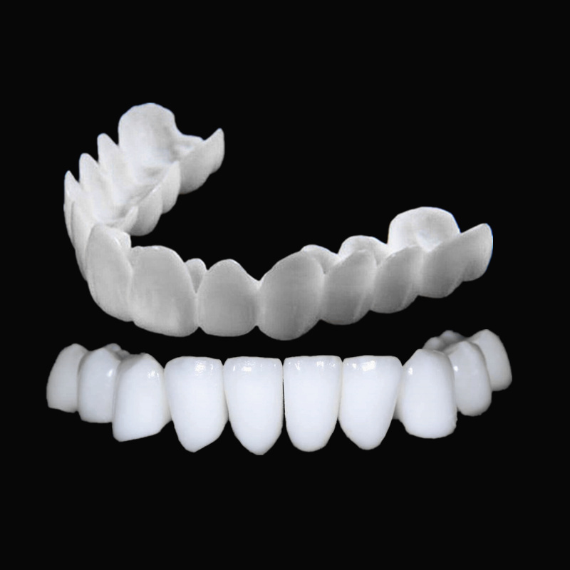 On Smile Dental Ober- und Unte – Teeth Whitening With Braces Bewertung und Preis