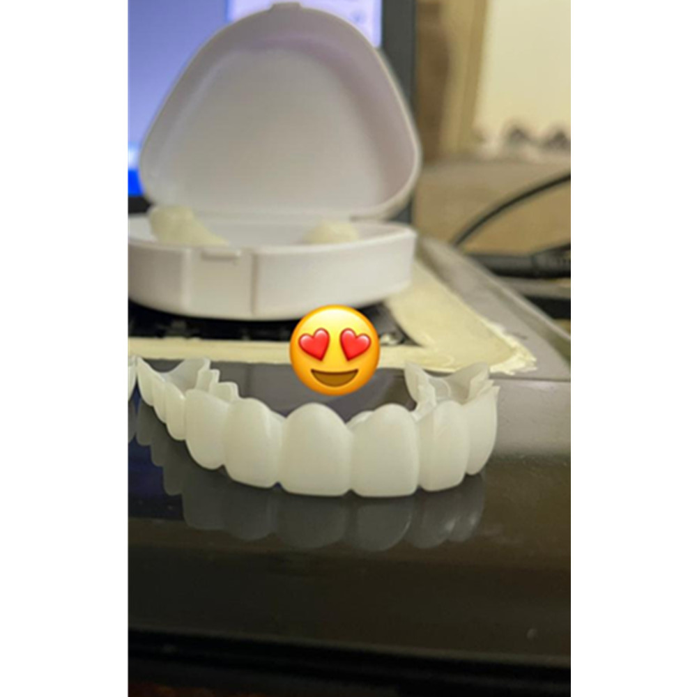On Smile Dental Ober- und Unte – Teeth Whitening With Braces Bewertung und Preis