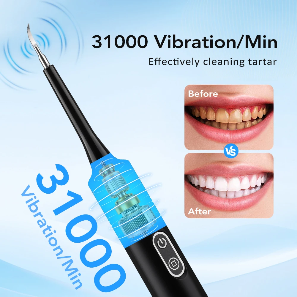 Elektrischer Schallvibrations- – Teeth Whitening Uk Bewertung und Preis